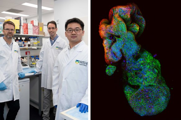 Professor Peter Gibbs, Associate Professor Oliver Sieber and Dr Tao Tan, and a image showing the structure of a cancer organoid they grew.