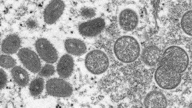 An electron microscope image shows mature, oval-shaped monkeypox virions.