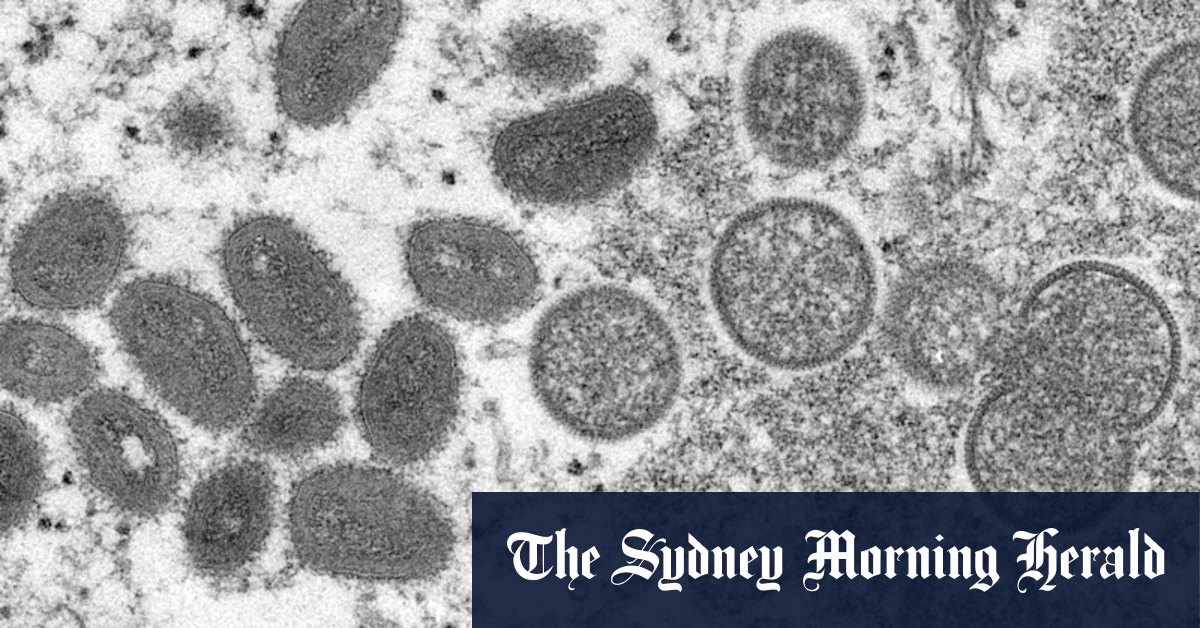 Monkeypox spreading locally in Melbourne - Vimarsana News