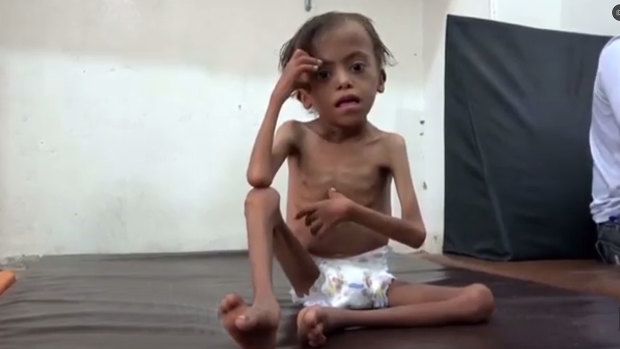 United Nations officials said in November that Yemen will face the world’s largest famine in decades if the Saudi-led coalition refuses to lift its blockade on deliveries of aid.