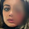 Police admit ‘harm and damage’ to Hannah Thomas after protest arrest