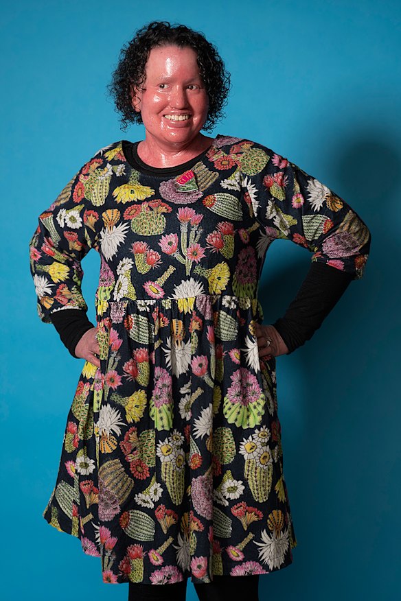 'We’re not treated the same when we go into stores' ... disability advocate, writer and speaker Carly Findlay.