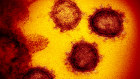 The race is on to beat the virus is on: the best brains are now dedicated to developing a vaccine