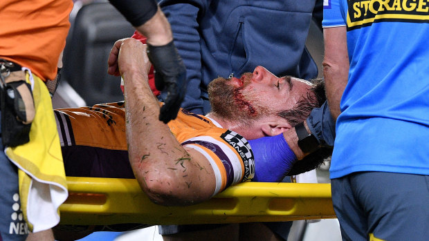 Sickening: Andrew McCullough is stretchered from the field after a hit from Dylan Napa.