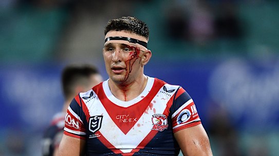 Victor Radley is unconcerned by his recent concussion history.