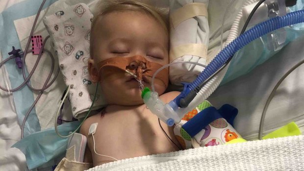 Nine-month-old Kaiden France is in Townsville Hospital's ICU in an induced coma.