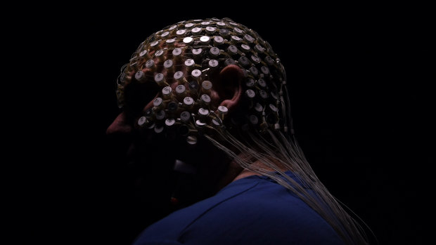 A patient wearing a high density EEG sensornet that monitors sleep brain waves in Sydney.