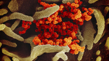 An electron microscope image shows SARS-CoV-2, orange, emerging from the surface of cells, green, cultured in the lab. 