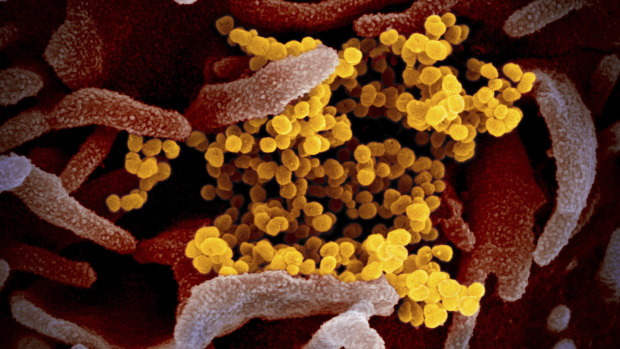 An electron microscope image shows the SARS-CoV-2 coronavirus (yellow) emerging from the surface of cells (pink) cultured in a US National Institutes of Health lab.