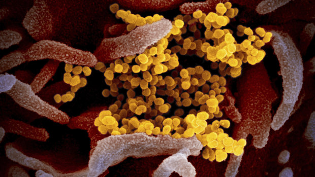 An electron microscope image shows the SARS-CoV-2 coronavirus (yellow) emerging from the surface of cells (pink) cultured in a US National Institutes of Health lab.