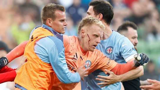 A bleeding Tom Glover of Melbourne City being escorted from the pitch on December 17, 2022.