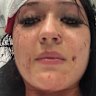 Zoe Samson-Wood was allegedly attacked by a co-worker now accused of stalking and attempted murder.