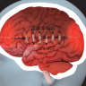 The Senate inquiry is investigating how sports at all levels handle concussion.
