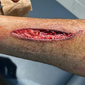 WARNING: GRAPHIC CONTENT. Newcastle Knights star Kai Pearce-Paul’s leg injury.