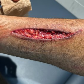 WARNING: GRAPHIC CONTENT. Newcastle Knights star Kai Pearce-Paul’s leg injury.