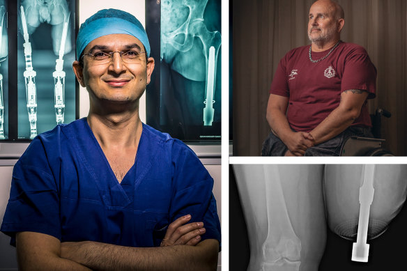 Munjed Al Muderis made his name in a procedure called osseointegration. For some it’s been an unhappy experience.