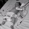 Alijana was just 13 weeks old when she was diagnosed.