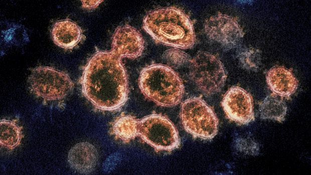 This electron microscope image provided by the US National Institute of Allergy and Infectious Diseases shows SARS-CoV-2 virus particles isolated from a patient, emerging from the surface of cells cultured in a lab.