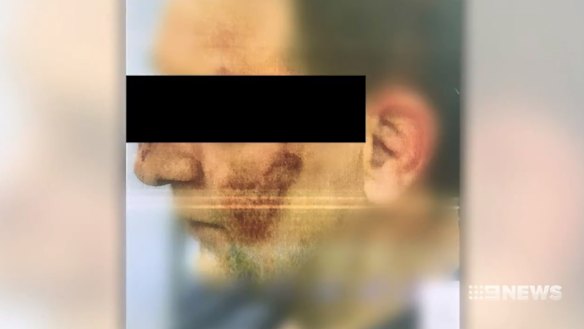 A prison officer after the attack on Thursday night.