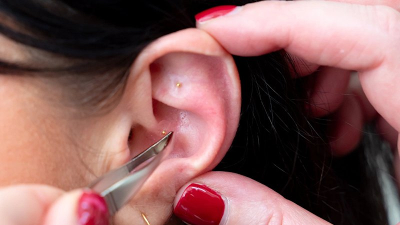 Reduced stress to sharpened jawlines: Are ear seeds the ultimate wellness hack?