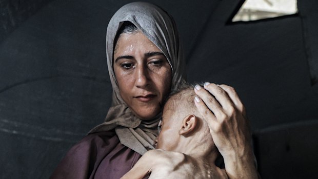 Muhammad Zakariya Ayyoub al-Matouq, 1, is facing life-threatening malnutrition.