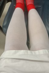 Michelle Minchin’s left leg ‘swollen like a balloon’ in compression stockings while waiting for a bed at Joondalup hospital.