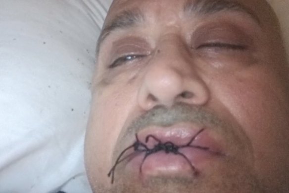 Tony Kellisar is on day six of a hunger strike.