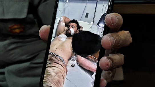 Kuta police show a photo of Nicholas Carr at Siloam Hospital.