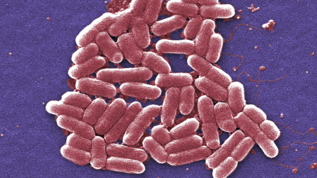 A colourised scan of E. coli bacteria taken using an electron microscope. E. coli can cause sepsis.