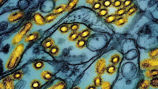 Particles of H5N1 bird flu flagged in yellow.