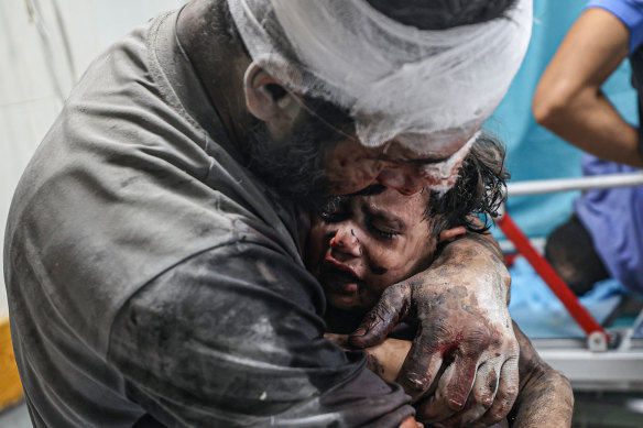 An injured child in Al-Aqsa Hospital. 