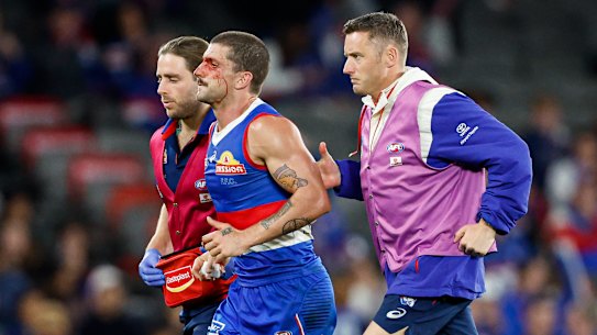 Tom Liberatore was ruled out of the game with concussion in the dying minutes of the match against Hawthorn.