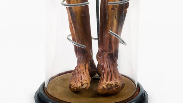 A child’s mummified legs have been on display in the Chau Chak Wing Mummy Room, but will be withdrawn in April. 