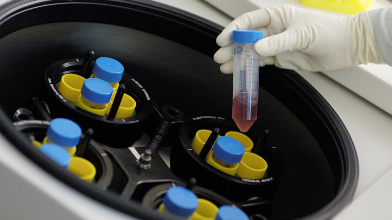 Mesoblast Shoots For The Stars