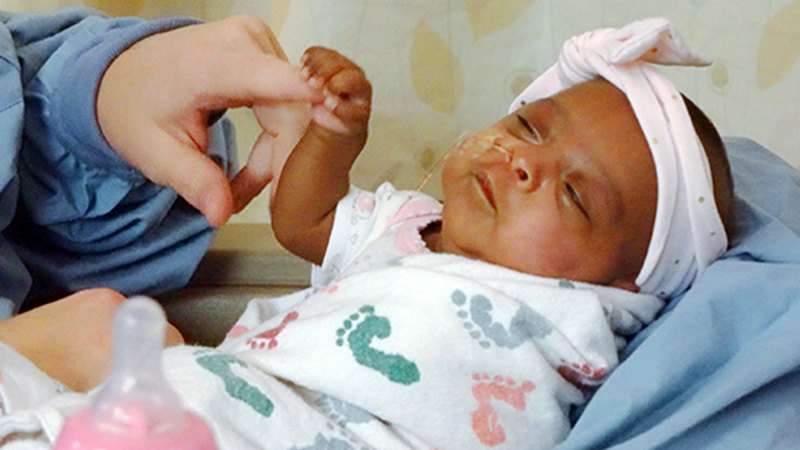 World s smallest baby Saybie at 245 grams a miracle