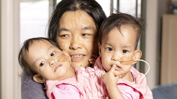 'Happier, heavier and ready to go': Conjoined twins Nima and Dawa closer to surgery