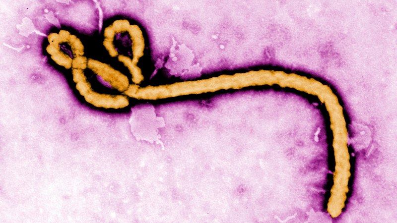 WHO declares global health emergency over Ebola outbreak. This rare variant has no approved treatments