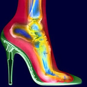 An X-ray of a foot in a high heel shoe.
