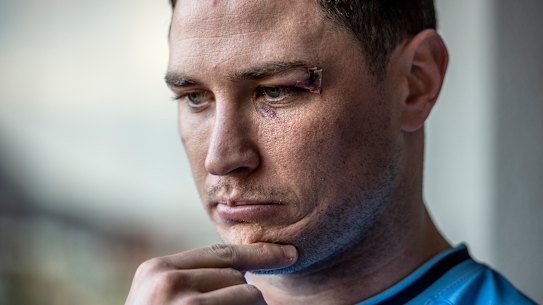 MItchell Moses says he is a calmer player in 2023, and he will need all of it against Queensland in a must-win Origin clash on Wednesday.