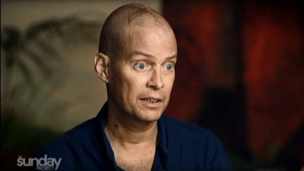 Tom Long pictured in an interview from The Sunday Project earlier this year before he underwent CAR-T Cell therapy clinical trial at the Fred Hutchinson Cancer Research Centre in Seattle.