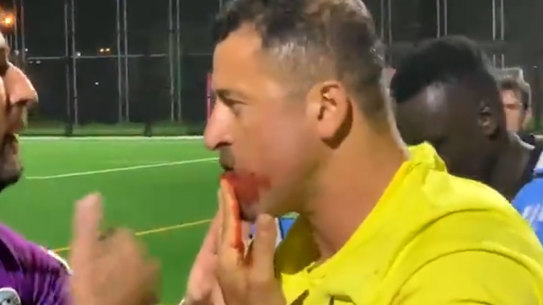 Referee’s jaw broken by spectator in Sydney soccer violence