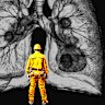 New research has estimated up to 300 workers across three tunnelling projects will be diagnosed with silicosis, an incurable lung disease.