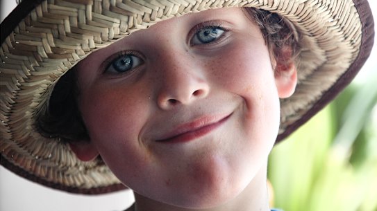 Lewis Jones the year after he was stung by a box jellyfish.