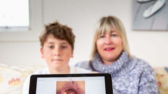 Gus Charles and his mother Sally.  Gus was diagnosed with a Buruli ulcer in 2017. 