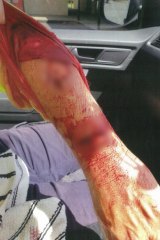 A postie bloodied after a run-in with a dog. 