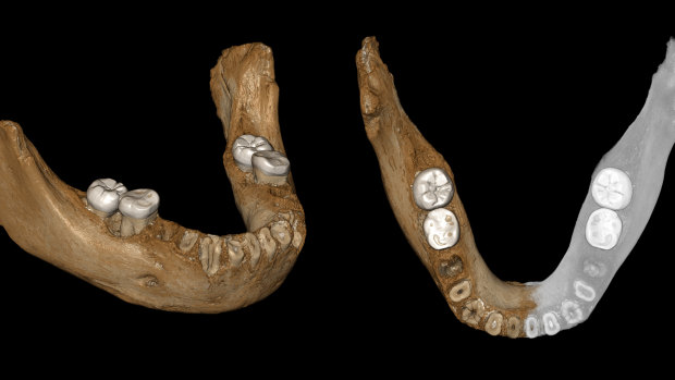 This combination of images provided by the Max Planck Institute for Evolutionary Anthropology, Leipzig, shows two views of a virtual reconstruction of the Xiahe mandible. At right, the simulated parts are in grey.

