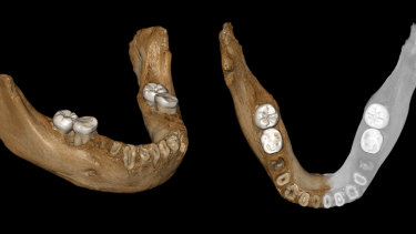 This combination of images provided by the Max Planck Institute for Evolutionary Anthropology, Leipzig, shows two views of a virtual reconstruction of the Xiahe mandible. At right, the simulated parts are in grey.

