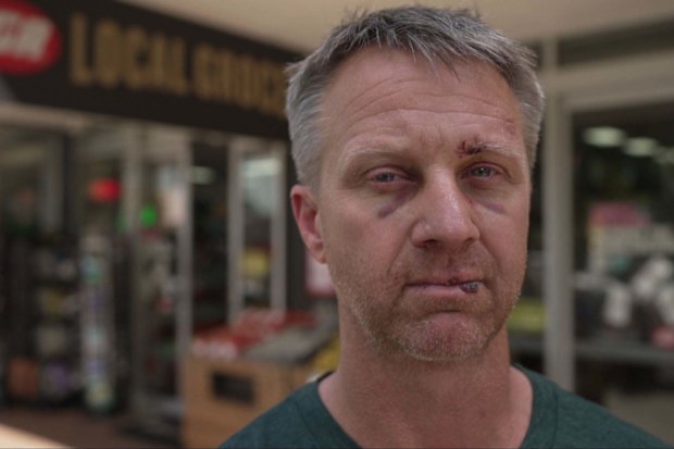 Shane Kensett  was brutally attacked at his IGA on the Sunshine Coast, and his physical wounds have healed but the psychological scars remain.