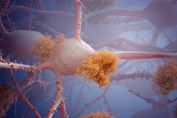 There have been growing calls for the issue of head injuries in sport to be given further attention.