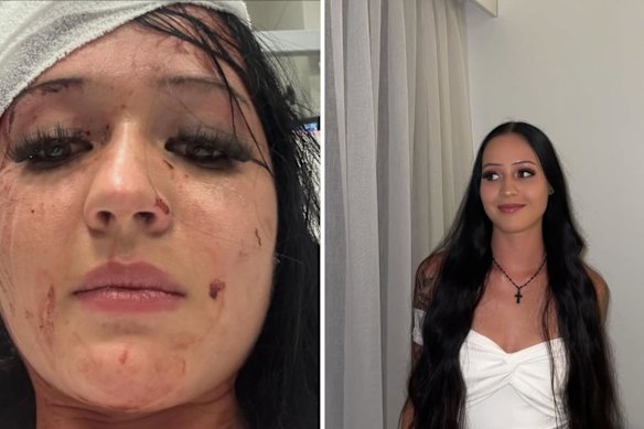 Zoe Samson-Wood was allegedly attacked by a co-worker now accused of stalking and attempted murder.